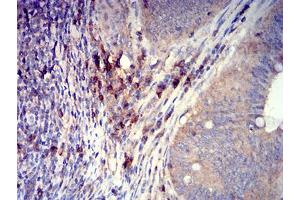 Immunohistochemistry (IHC) image for anti-SLAM Family Member 7 (SLAMF7) (AA 23-226) antibody (ABIN5611285)