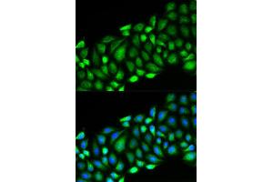 Immunofluorescence analysis of HeLa cell using RIPK2 antibody. (RIPK2 抗体  (AA 1-540))