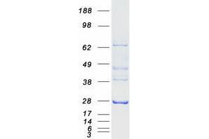Validation with Western Blot