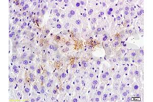 Formalin-fixed and paraffin embedded rat liver tissue labeled with Anti-Tsg101 Polyclonal Antibody (ABIN685507), Unconjugated at 1:200 followed by conjugation to the secondary antibody, (SP-0023), and DAB staining (TSG101 抗体  (AA 4-120))