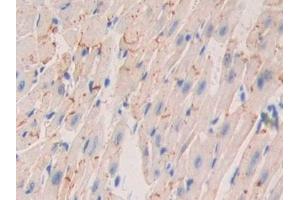 Immunohistochemistry (IHC) image for anti-Nexilin (NEXN) (AA 421-607) antibody (ABIN7443539)