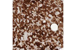 Immunohistochemical staining (Formalin-fixed paraffin-embedded sections) of human adrenal gland with PARP4 polyclonal antibody  shows strong nuclear and cytoplasmic positivity in cortical cells. (PARP4 抗体  (AA 247-392))