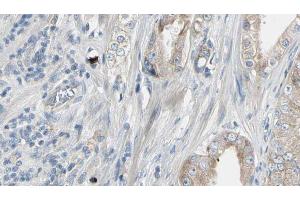 ABIN6272944 at 1/100 staining Human prostate tissue by IHC-P. (HMGCS1 抗体  (Internal Region))