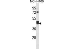 Western Blotting (WB) image for anti-Isocitrate Dehydrogenase 3 (NAD+) gamma (IDH3G) antibody (ABIN3004326) (IDH3G 抗体)