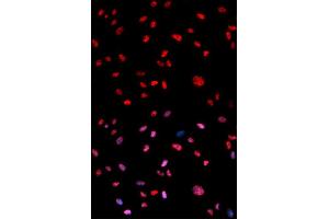 Immunofluorescence analysis of U2OS cells using Phospho-Jun-T239 antibody (ABIN5969906). (C-JUN 抗体  (pThr239))