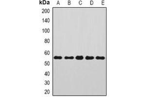 Western blot analysis of Annexin A11 expression in Jurkat (A), SKOV3 (B), A549 (C), mouse kidney (D), rat brain (E) whole cell lysates. (Annexin A11 抗体)