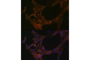 Immunofluorescence (IF) image for anti-serine threonine Kinase 39 (STK39) antibody (ABIN1682890)