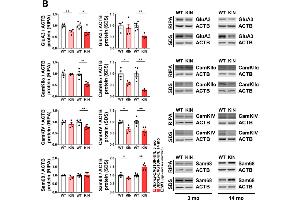 Western Blotting (WB) image for anti-KH Domain Containing, RNA Binding, Signal Transduction Associated 1 (KHDRBS1) (C-Term) antibody (ABIN6142829)