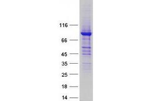 Western Blotting (WB) image for Aldehyde Dehydrogenase 16 Family, Member A1 (ALDH16A1) (Transcript Variant 1) protein (Myc-DYKDDDDK Tag) (ABIN2714536)