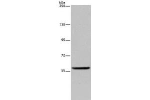 Western Blot analysis of Human fetal brain tissue using LBR Polyclonal Antibody at dilution of 1:300 (Lamin B Receptor 抗体)