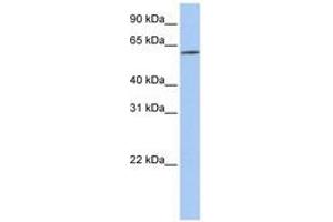 Image no. 1 for anti-Solute Carrier Family 22 (Organic Cation Transporter), Member 14 (SLC22A14) (AA 144-193) antibody (ABIN6740846) (SLC22A14 抗体  (AA 144-193))
