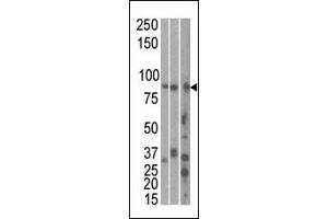 The anti-RK1 C-term Pab 7144b is used in Western blot to detect RK1 in, from left to right, Hela, T47D, and mouse brain cell line/ tissue lysate. (MARK1 抗体  (C-Term))
