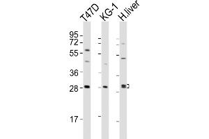 All lanes : Anti-HAVCR2 Antibody (Center) at 1:2000 dilution Lane 1: T47D whole cell lysates Lane 2: KG-1 whole cell lysates Lane 3: human liver lysates Lysates/proteins at 20 μg per lane. (TIM3 抗体  (AA 167-194))