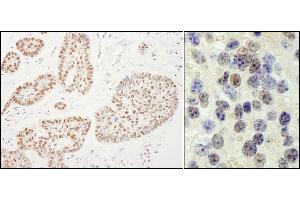anti-RNA polymerase-associated protein RTF1 homolog (RTF1) (C-Term) antibody