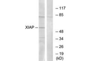 Western blot analysis of extracts from 293 cells, using XIAP (Ab-87) Antibody. (Intestinal Alkaline Phosphatase 抗体  (AA 53-102))