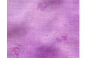 Immunohistochemistry (IHC) image for Osteoclast (Rat) Culture Kit (ABIN956046) (Osteoclast (大鼠) Culture Kit)
