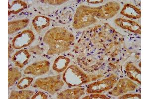 IHC image of ABIN7151580 diluted at 1:400 and staining in paraffin-embedded human kidney tissue performed on a Leica BondTM system. (ELP3/KAT9 抗体  (AA 1-85))