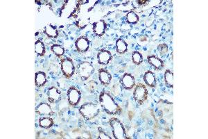 Immunohistochemistry of paraffin-embedded rat kidney using NDUFS4 Rabbit pAb (ABIN6132405, ABIN6144489, ABIN6144491 and ABIN6222016) at dilution of 1:100 (40x lens). (NDUFS4 抗体  (AA 1-175))