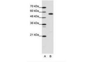 Image no. 1 for anti-Coronin, Actin Binding Protein, 1A (CORO1A) (AA 181-230) antibody (ABIN6736110) (Coronin 1a 抗体  (AA 181-230))