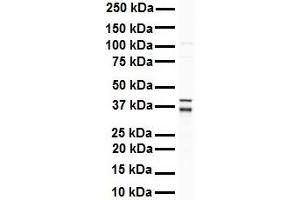 WB Suggested Anti-GAPDH antibody Titration: 1 ug/mL Sample Type: Human Raji (GAPDH 抗体  (Middle Region))