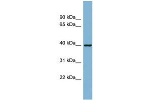 WB Suggested Anti-ELMOD2 Antibody Titration: 0. (ELMOD2 抗体  (N-Term))