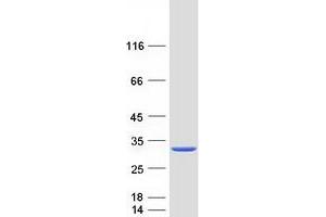 Western Blotting (WB) image for HD Domain Containing 2 (HDDC2) protein (Myc-DYKDDDDK Tag) (ABIN2722528)
