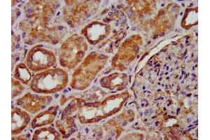 IHC image of ABIN7149571 diluted at 1:200 and staining in paraffin-embedded human kidney tissue performed on a Leica BondTM system. (PDSS2 抗体  (AA 292-387))