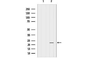 Western blot analysis of lysates from Hela, using OBFC2A Antibody. (OBFC2A 抗体  (Internal Region))