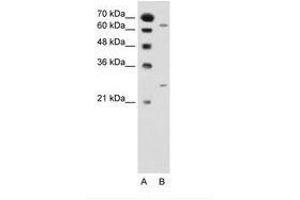 Image no. 1 for anti-N-Acetyltransferase 2 (Arylamine N-Acetyltransferase) (NAT2) (AA 151-200) antibody (ABIN205032) (NAT2 抗体  (AA 151-200))