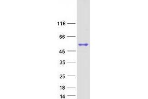 Western Blotting (WB) image for Sp6 Transcription Factor (SP6) protein (Myc-DYKDDDDK Tag) (ABIN2732482)