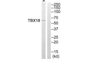 Western Blotting (WB) image for anti-T-Box 18 (TBX18) (Internal Region) antibody (ABIN1852256) (T-Box 18 抗体  (Internal Region))