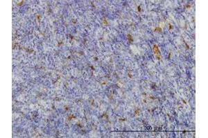Image no. 1 for anti-Malic Enzyme 1, NADP(+)-Dependent, Cytosolic (ME1) (AA 1-573) antibody (ABIN598801) (ME1 抗体  (AA 1-573))