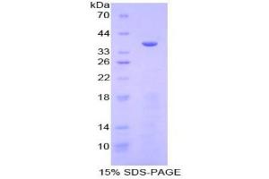 SDS-PAGE analysis of Human Meprin A alpha Protein. (MEP1A 蛋白)
