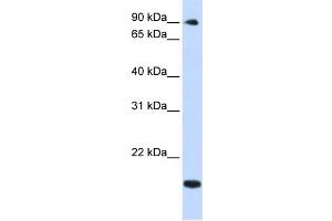 WB Suggested Anti-TSR1 Antibody Titration:  0. (TSR1 抗体  (Middle Region))