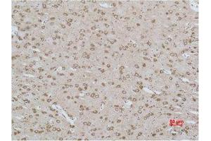 Immunohistochemistry (IHC) analysis of paraffin-embedded Rat Brain Tissue using CACNG3 Polyclonal Antibody. (CACNG3 抗体)