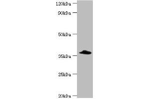Western blot All lanes: Complement factor H-related protein 3 antibody at 6 μg/mL + Rat heart tissue Secondary Goat polyclonal to rabbit IgG at 1/10000 dilution Predicted band size: 38, 31 kDa Observed band size: 38 kDa (CFHR3 抗体  (AA 80-200))