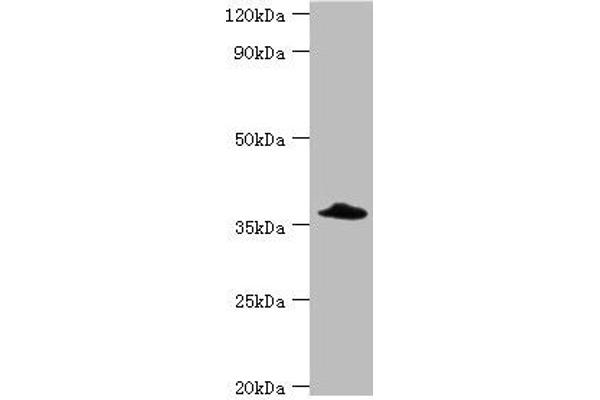 CFHR3 antibody  (AA 80-200)