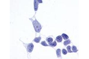 Anti-Frizzled-6 antibody immunocytochemistry (ICC) staining of untransfected HEK293 human embryonic kidney cells. (FZD6 抗体  (N-Term))