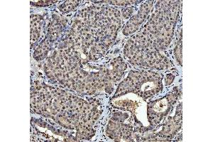 IHC analysis of hnRNP L/HNRNPL using anti-hnRNP L/HNRNPL antibody (ABIN7600130).