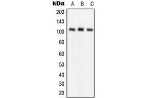 Western blot analysis of GLUR1 (pS849) expression in Jurkat (A), mouse kidney (B), rat liver (C) whole cell lysates. (Glutamate Receptor 1 抗体  (C-Term, pSer849))