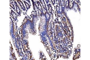 IHC analysis of LSR using anti-LSR antibody (ABIN7599514).