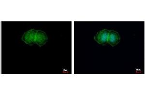 ICC/IF Image L-Plastin antibody detects LCP1 protein at membrane by immunofluorescent analysis. (LCP1 抗体)