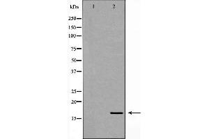 Western blot analysis of 293T whole cell lysates, using NPC2 Antibody. (NPC2 抗体  (N-Term))