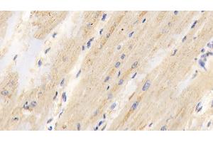 Detection of PDHA1 in Human Cardiac Muscle Tissue using Polyclonal Antibody to Pyruvate dehydrogenase alpha 1 (PDHA1)