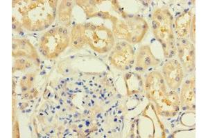 Immunohistochemistry of paraffin-embedded human kidney tissue using ABIN7158927 at dilution of 1:100 (MR1 抗体  (AA 150-253))