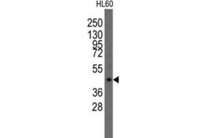 Western Blotting (WB) image for anti-LIM Homeobox Transcription Factor 1, alpha (LMX1A) antibody (ABIN2997858) (LMX1A 抗体)