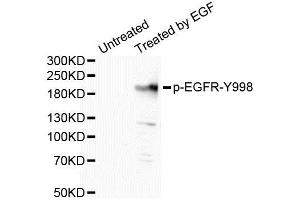 Western Blotting (WB) image for anti-Epidermal Growth Factor Receptor (EGFR) (pTyr998) antibody (ABIN1870110) (EGFR 抗体  (pTyr998))