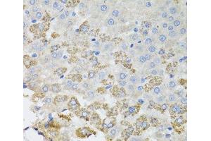 Immunohistochemistry of paraffin-embedded Rat liver using TROVE2 Polyclonal Antibody at dilution of 1:100 (40x lens). (TROVE2 抗体)