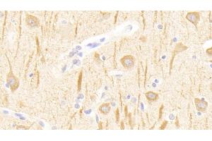 Detection of GRM1 in Human Cerebrum Tissue using Polyclonal Antibody to Glutamate Receptor, Metabotropic 1 (GRM1) (Metabotropic Glutamate Receptor 1 抗体  (AA 165-592))
