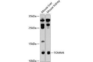 Western blot analysis of extracts of various cell lines, using TOMM6 antibody  at 1:1000 dilution. (TOMM6 抗体  (AA 1-74))